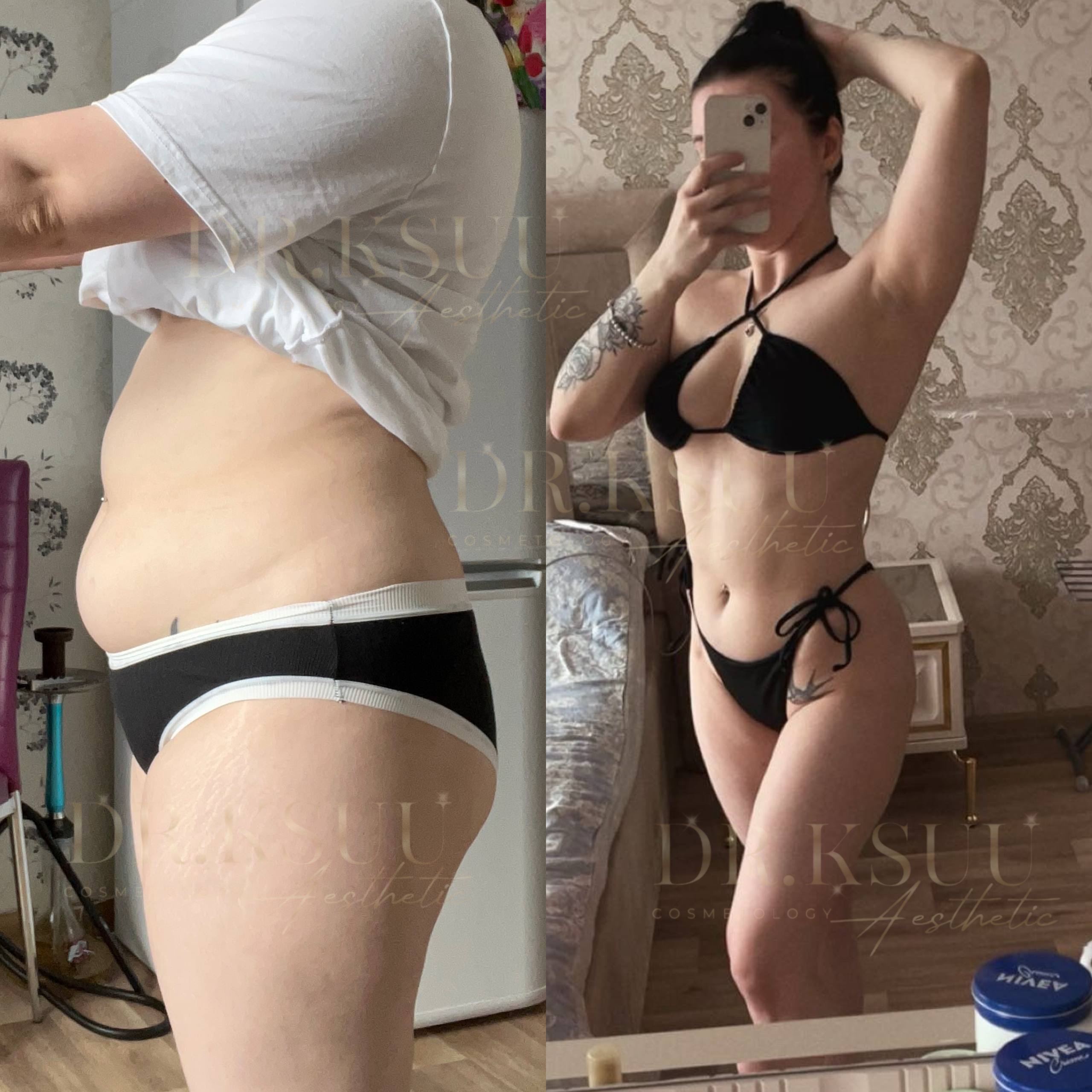 Результат клієнтки Оксани