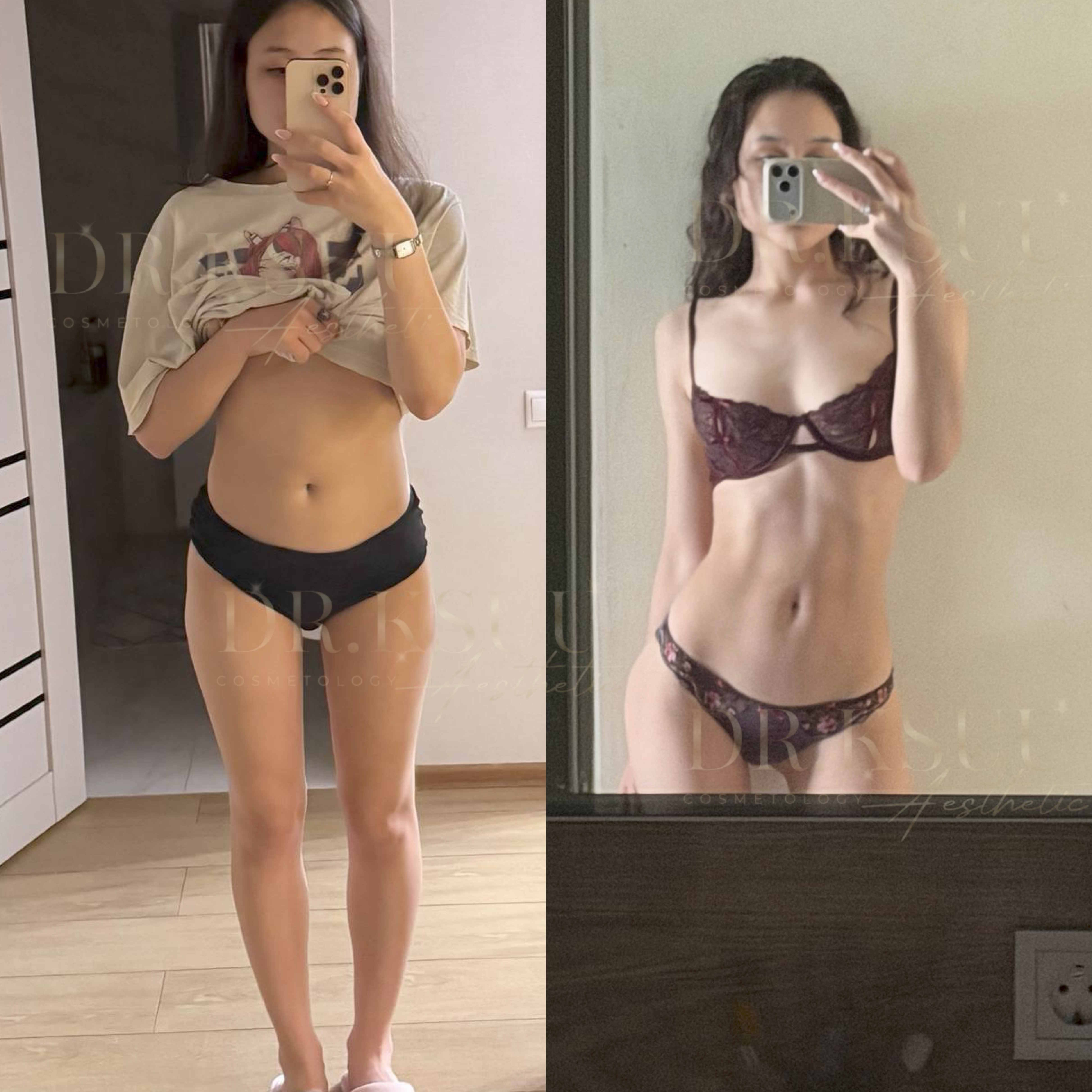 Результат клієнтки Марії