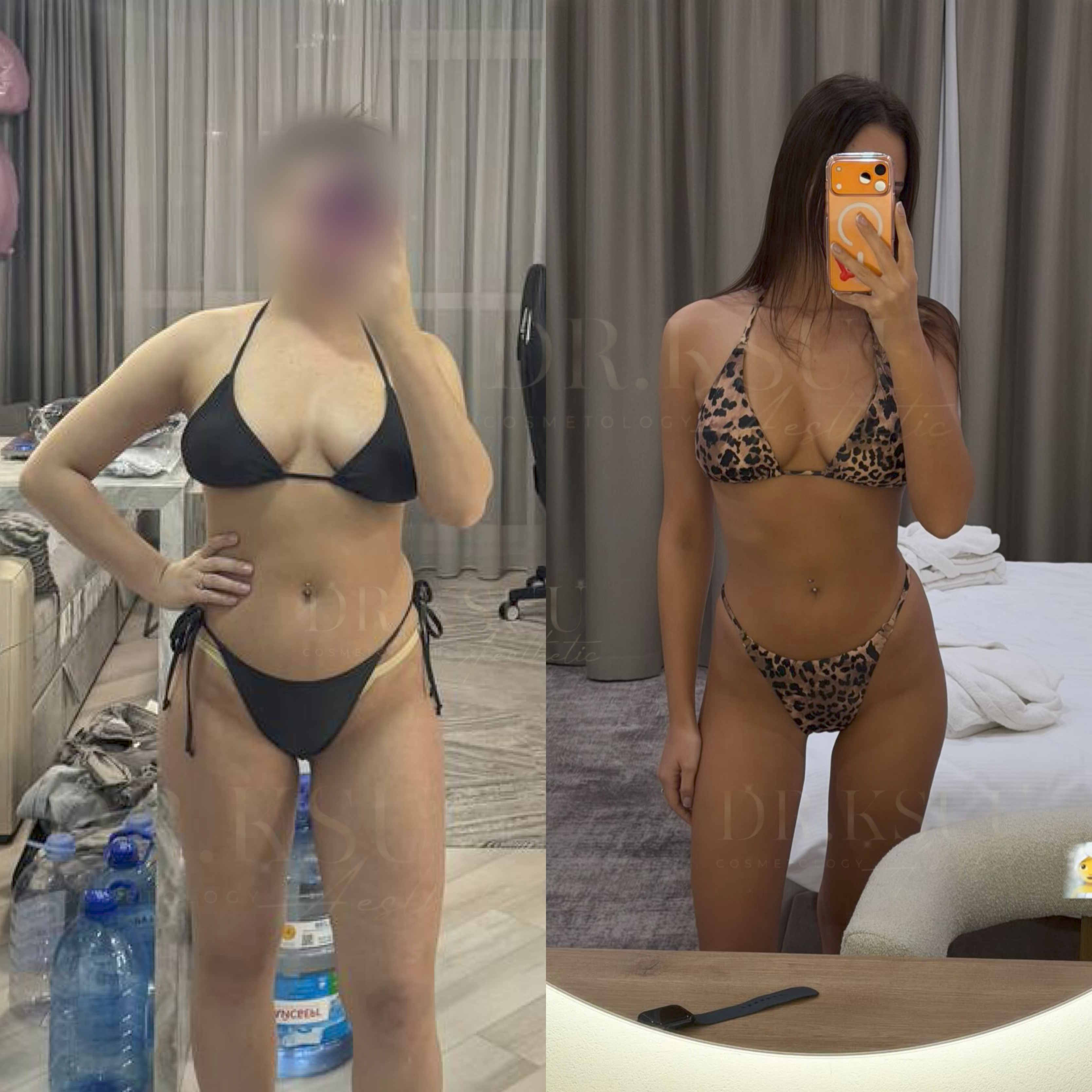 Результат клієнта Андрія