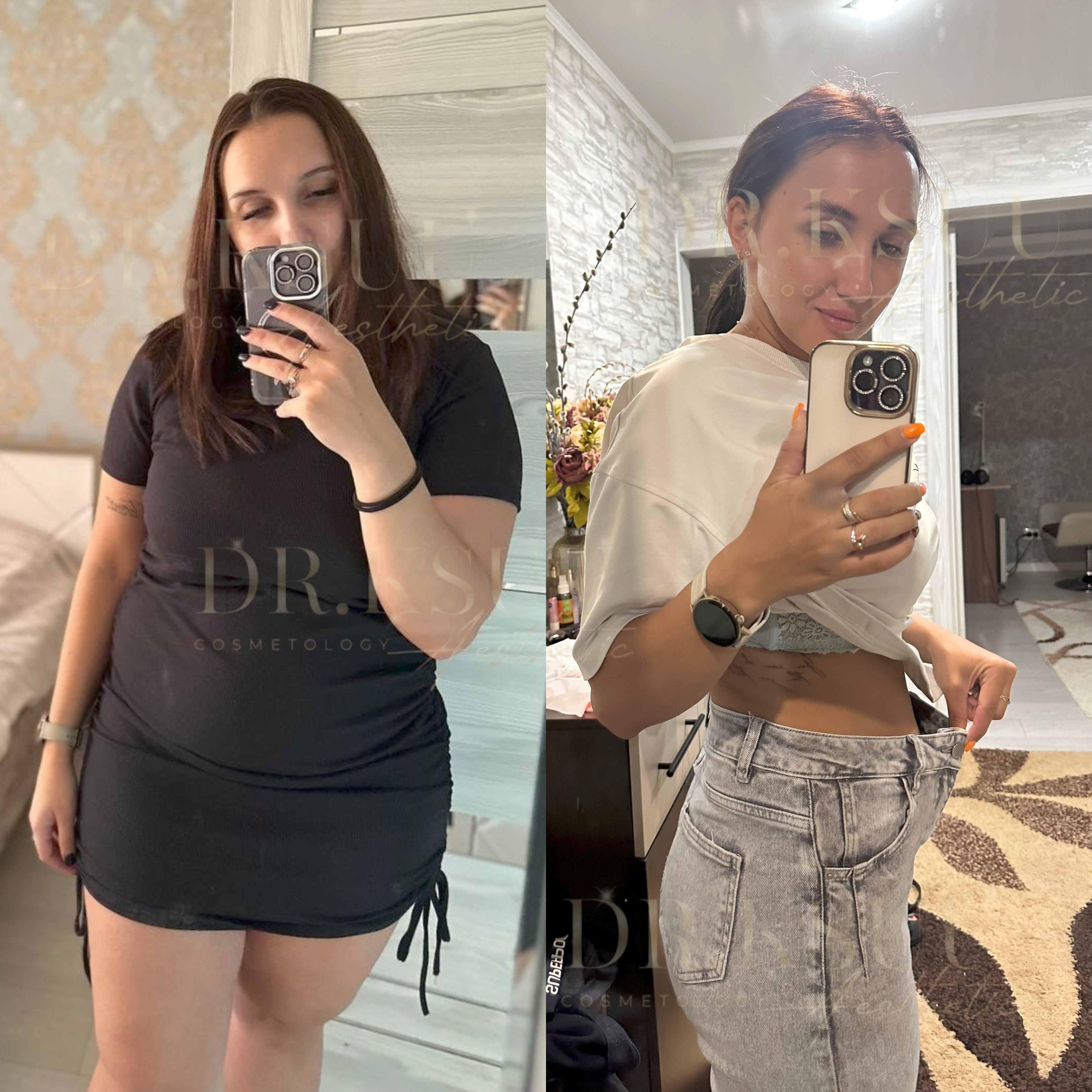 Результат клієнтки Вікторії